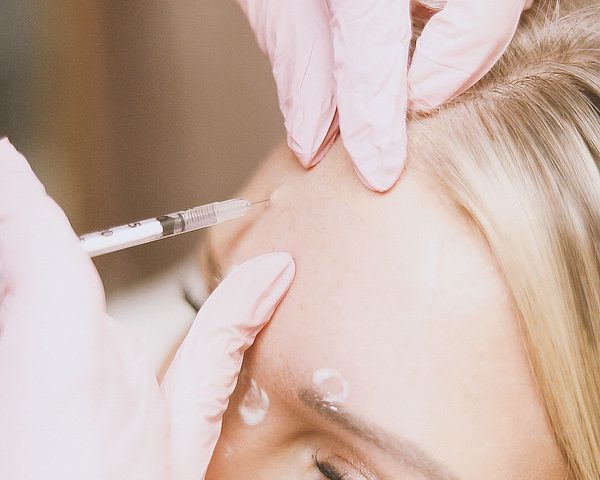 Botulinum toxin (Botox) treatment applied with a fine needle to the forehead area — illustrative image