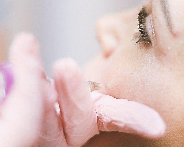 Dermal filler applied with a fine needle to the lip area — illustrative image