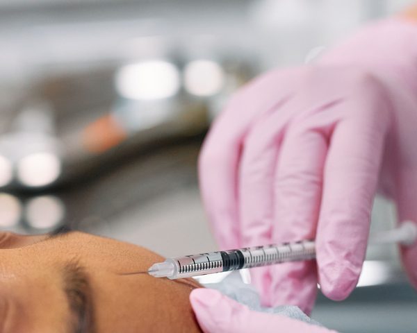 Mesotherapy applied with a fine needle to the facial area — illustrative image